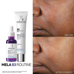 La Roche-Posay Mela B3 Serum 30ml